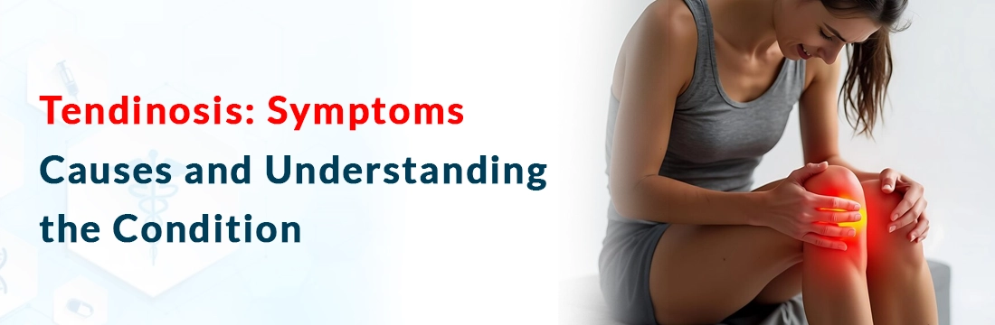  Tendinosis: Symptoms, Causes and Understanding the Condition